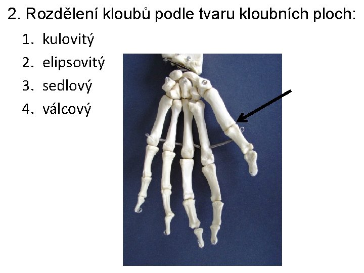 2. Rozdělení kloubů podle tvaru kloubních ploch: 1. 2. 3. 4. kulovitý elipsovitý sedlový