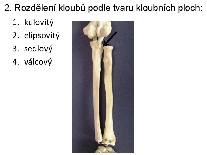 2. Rozdělení kloubů podle tvaru kloubních ploch: 1. 2. 3. 4. kulovitý elipsovitý sedlový