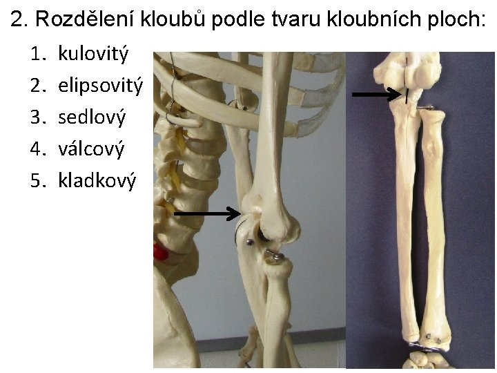 2. Rozdělení kloubů podle tvaru kloubních ploch: 1. 2. 3. 4. 5. kulovitý elipsovitý