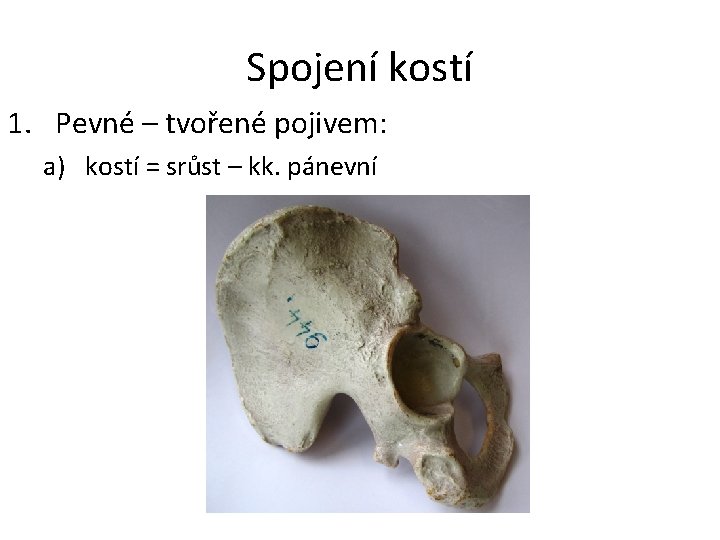 Spojení kostí 1. Pevné – tvořené pojivem: a) kostí = srůst – kk. pánevní