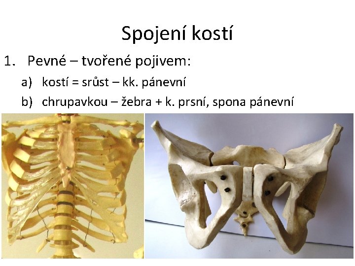 Spojení kostí 1. Pevné – tvořené pojivem: a) kostí = srůst – kk. pánevní