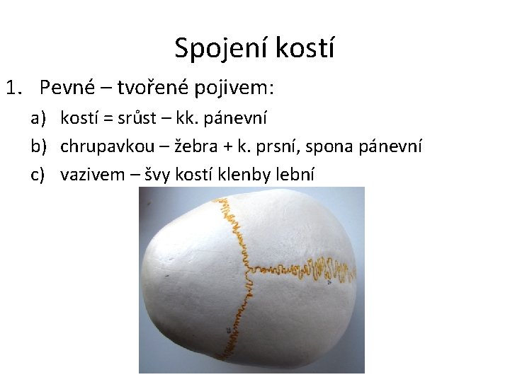 Spojení kostí 1. Pevné – tvořené pojivem: a) kostí = srůst – kk. pánevní