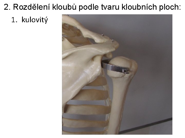 2. Rozdělení kloubů podle tvaru kloubních ploch: 1. kulovitý 