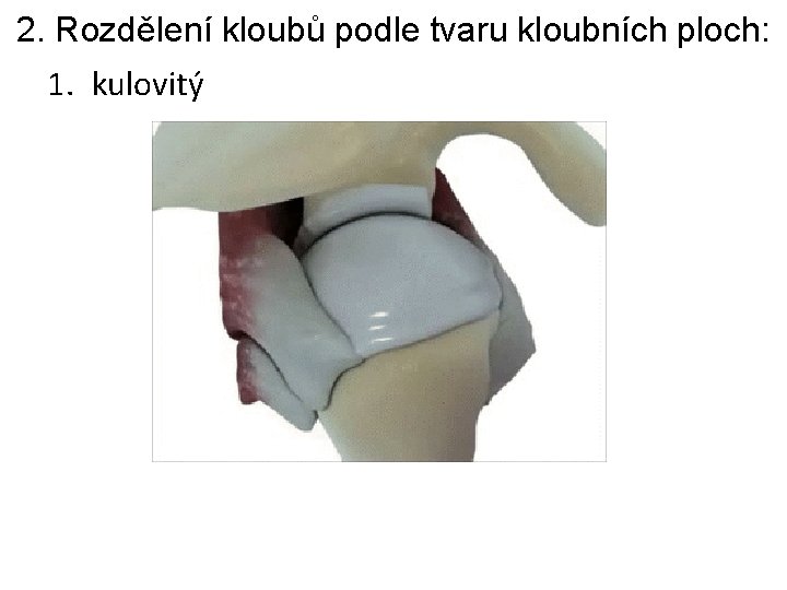 2. Rozdělení kloubů podle tvaru kloubních ploch: 1. kulovitý 