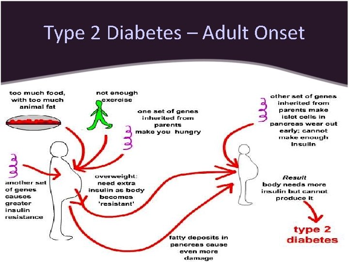 Type 2 Diabetes – Adult Onset 