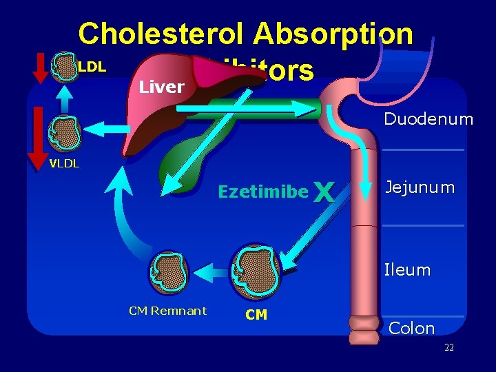 Cholesterol Absorption LDL Inhibitors Liver Duodenum VLDL Ezetimibe X Jejunum Ileum CM Remnant CM