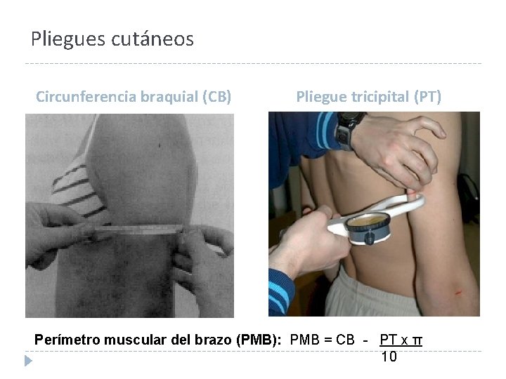 Pliegues cutáneos Circunferencia braquial (CB) Pliegue tricipital (PT) Perímetro muscular del brazo (PMB): PMB