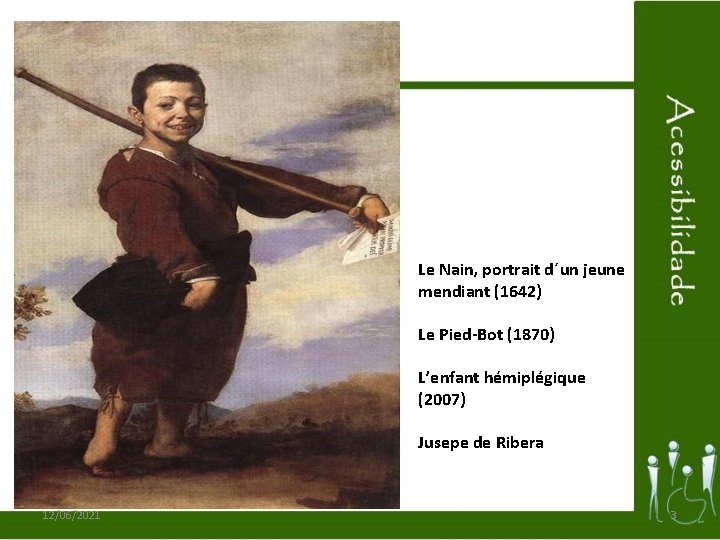 Le Nain, portrait d´un jeune mendiant (1642) Le Pied-Bot (1870) L’enfant hémiplégique (2007) Jusepe
