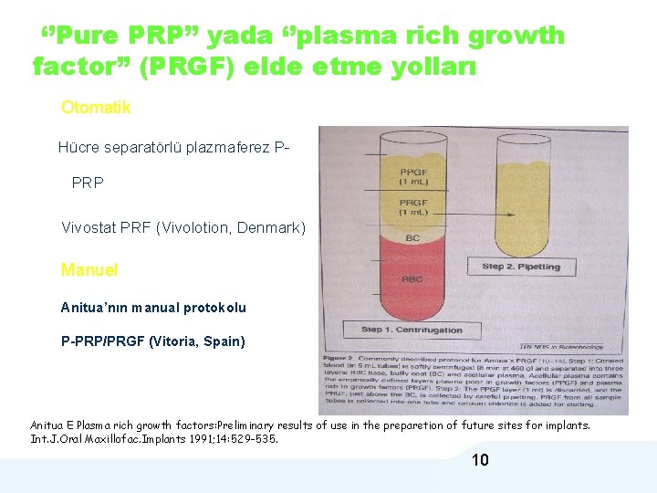 ‘’Pure PRP’’ yada ‘’plasma rich growth factor’’ (PRGF) elde etme yolları Otomatik Hücre separatörlü