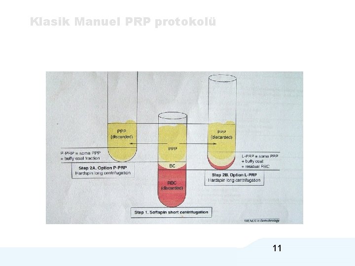 Klasik Manuel PRP protokolü 11 