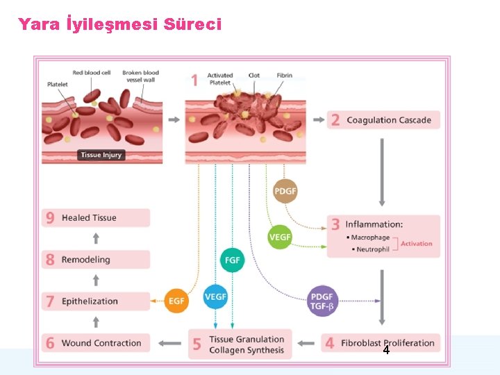 Yara İyileşmesi Süreci 4 