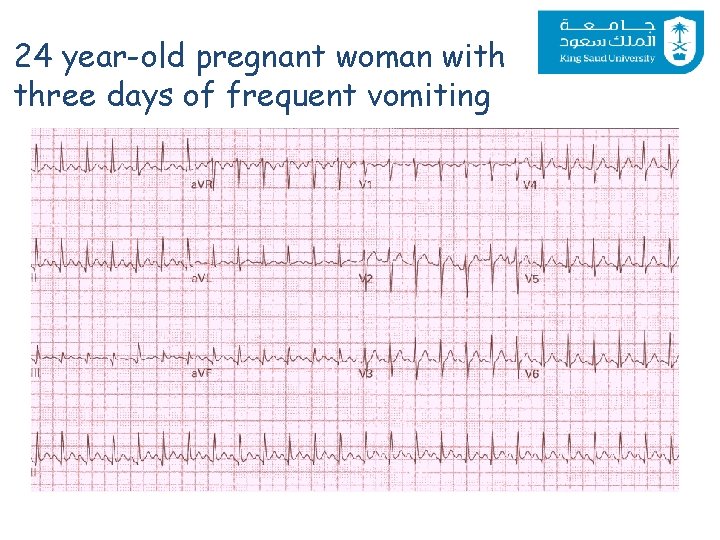 24 year-old pregnant woman with three days of frequent vomiting 