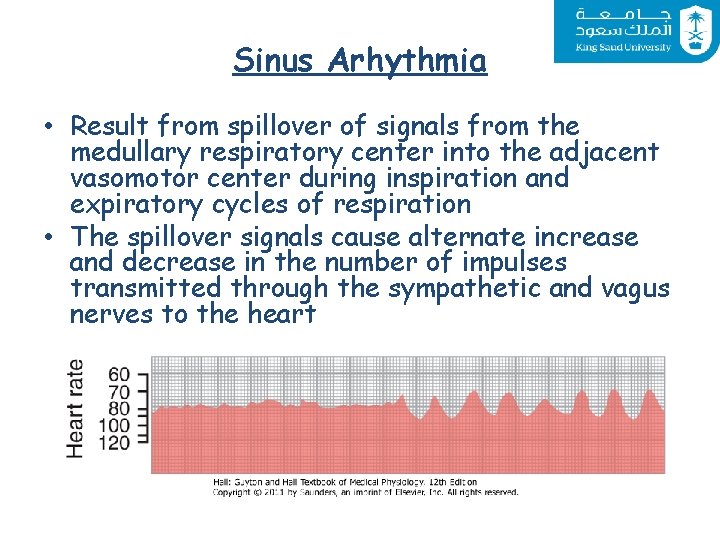 Sinus Arhythmia • Result from spillover of signals from the medullary respiratory center into