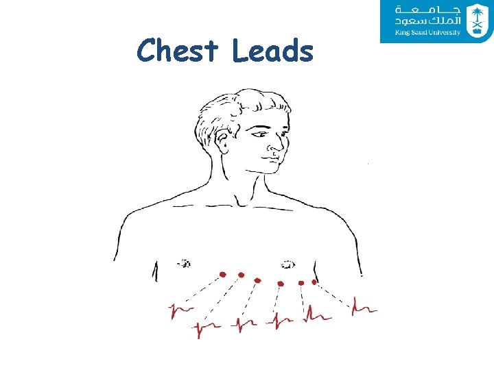 Chest Leads 