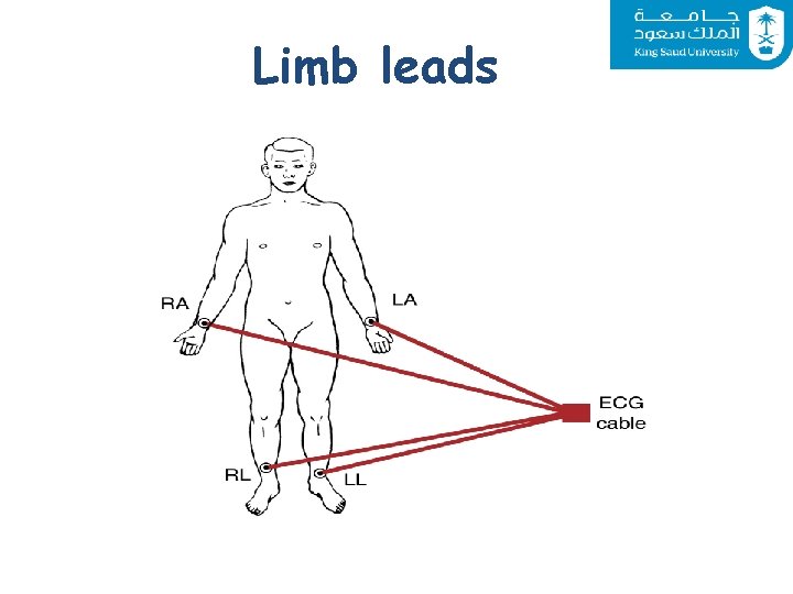 Limb leads 