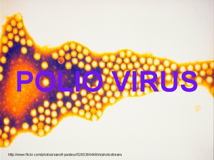 POLIO VIRUS http: //www. flickr. com/photos/sanofi-pasteur/5280384448/in/photostream/ 