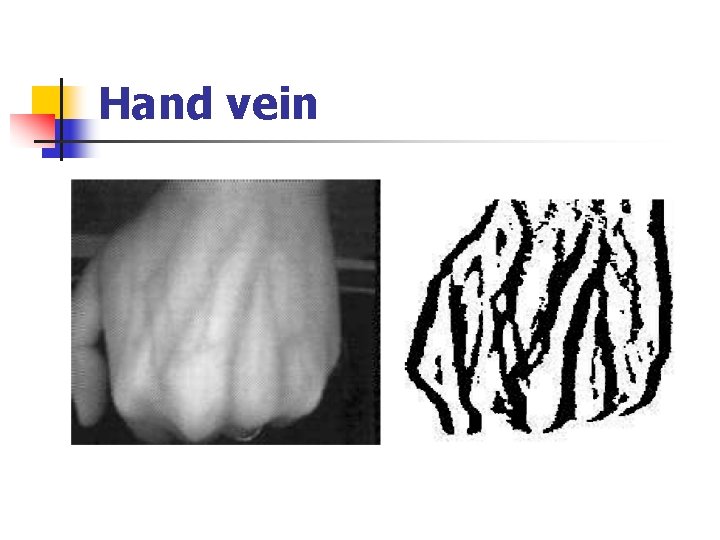 Hand vein 