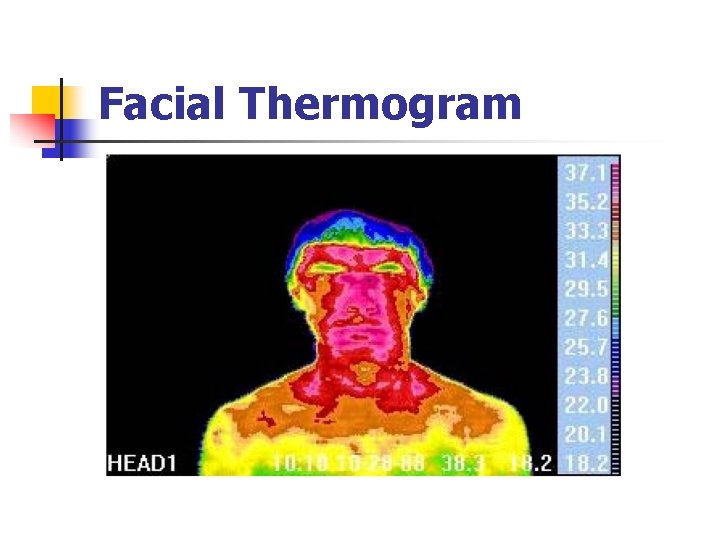 Facial Thermogram 