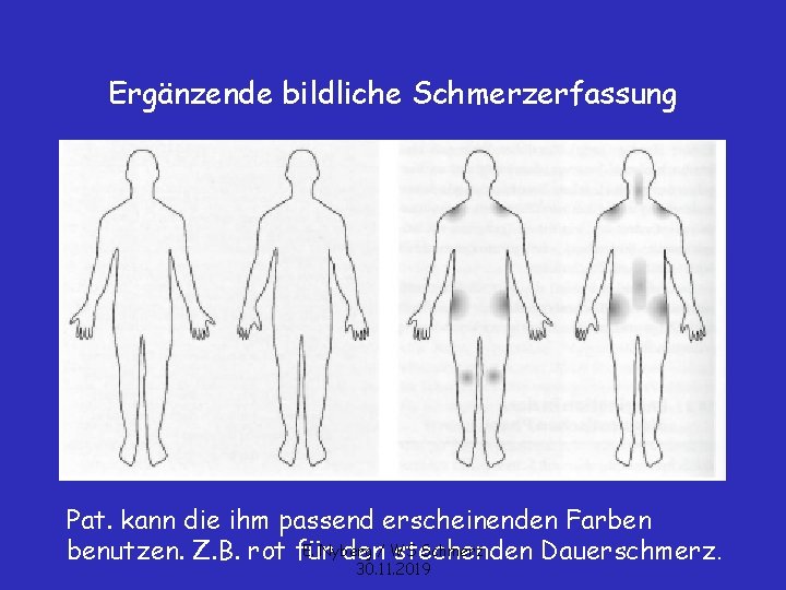 Ergänzende bildliche Schmerzerfassung Pat. kann die ihm passend erscheinenden Farben E. Nyberg Schmerz benutzen.