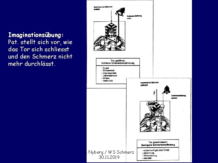 Imaginationsübung: Pat. stellt sich vor, wie das Tor sich schliesst und den Schmerz nicht