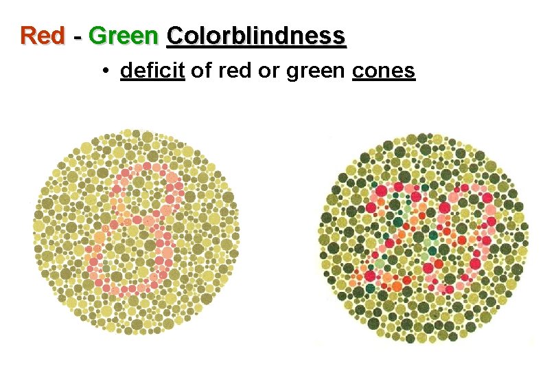 Red - Green Colorblindness • deficit of red or green cones 