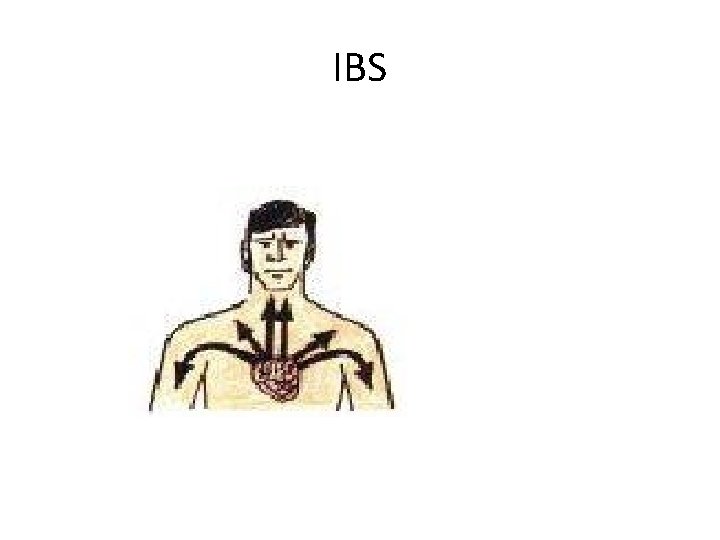 IBS 
