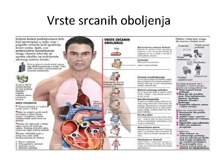 Vrste srcanih oboljenja 