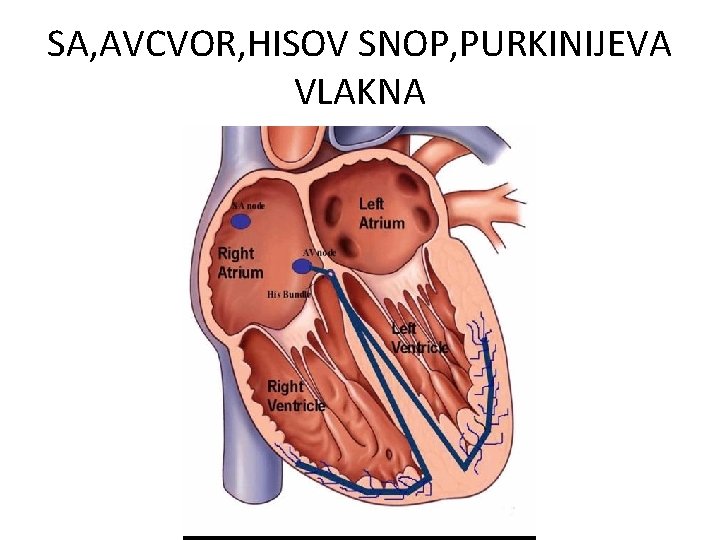 SA, AVCVOR, HISOV SNOP, PURKINIJEVA VLAKNA 