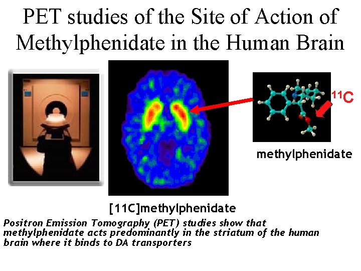 PET studies of the Site of Action of Methylphenidate in the Human Brain 11