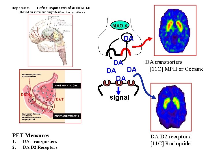 Dopamine- Deficit Hypothesis of ADHD/HKD (based on stimulant drug site- of- action hypothesis) MAO