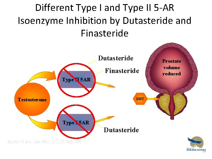 Different Type I and Type II 5 -AR Isoenzyme Inhibition by Dutasteride and Finasteride