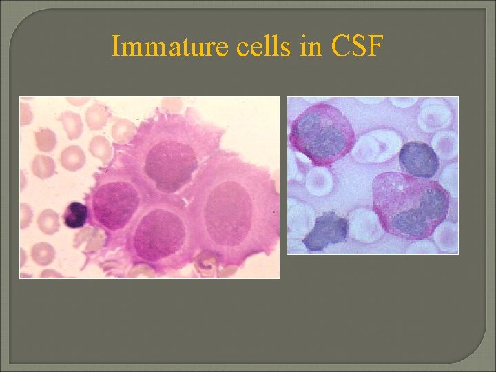 Immature cells in CSF 