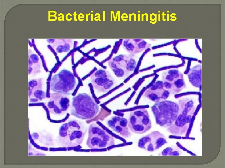 Bacterial Meningitis 