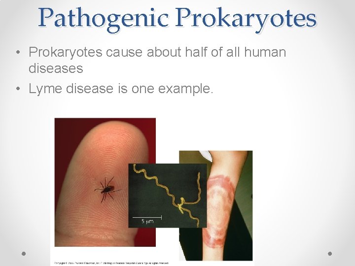Pathogenic Prokaryotes • Prokaryotes cause about half of all human diseases • Lyme disease