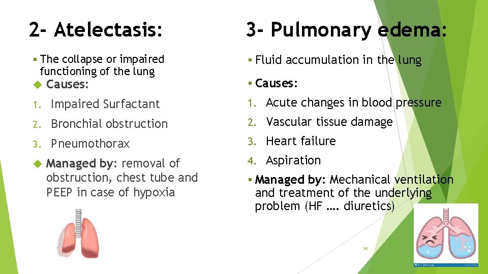 2 - Atelectasis: § The collapse or impaired functioning of the lung Causes: 3