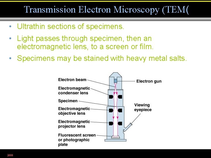Transmission Electron Microscopy (TEM( • Ultrathin sections of specimens. • Light passes through specimen,