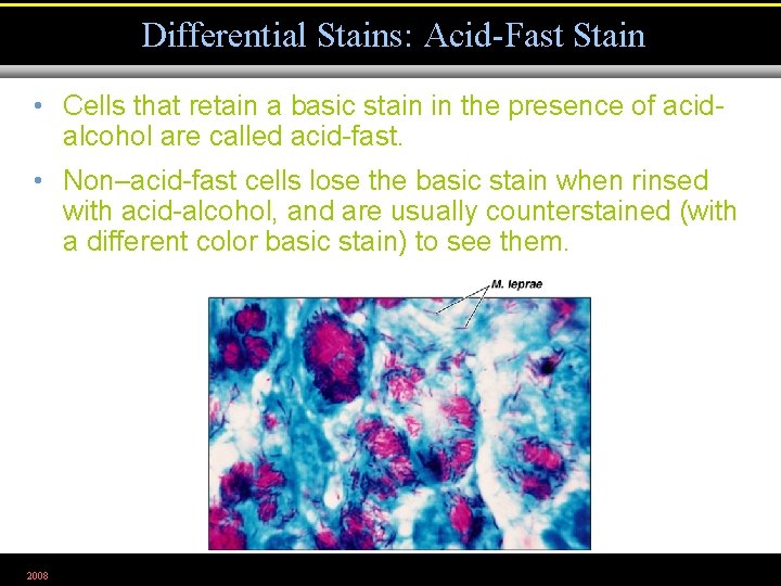 Differential Stains: Acid-Fast Stain • Cells that retain a basic stain in the presence