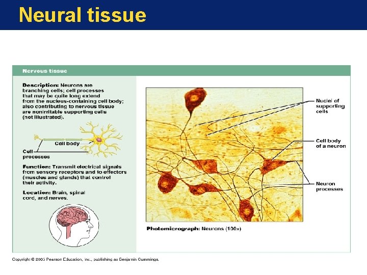 Neural tissue 