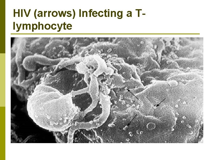 HIV (arrows) Infecting a Tlymphocyte 