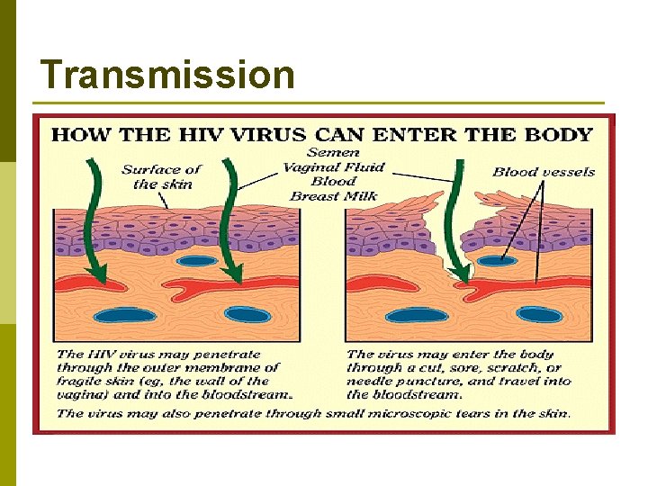 Transmission 