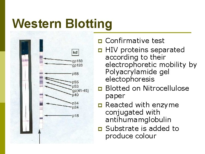 Western Blotting p p p Confirmative test HIV proteins separated according to their electrophoretic