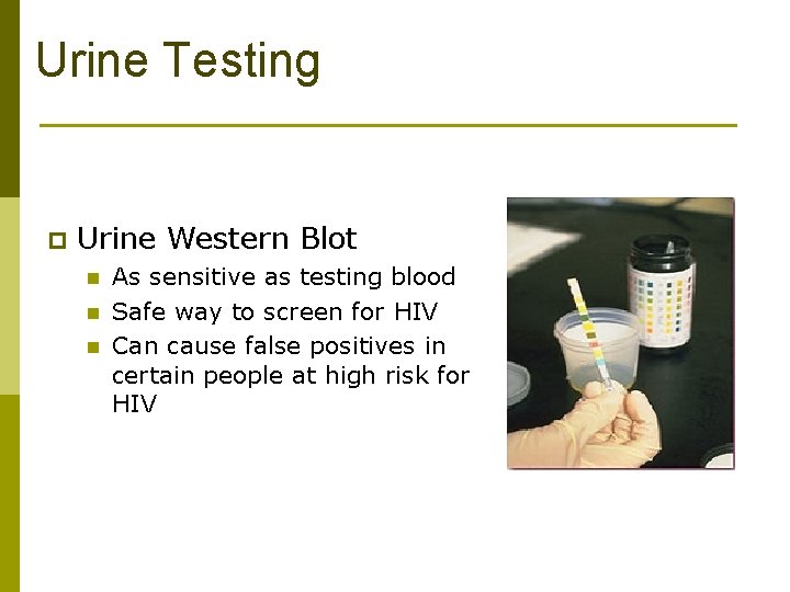 Urine Testing p Urine Western Blot n n n As sensitive as testing blood