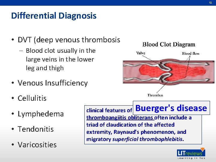 12 Differential Diagnosis • DVT (deep venous thrombosis – Blood clot usually in the