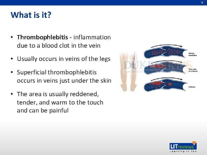 6 What is it? • Thrombophlebitis - inflammation due to a blood clot in