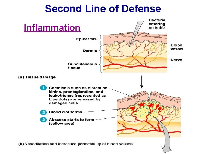 Second Line of Defense Inflammation 