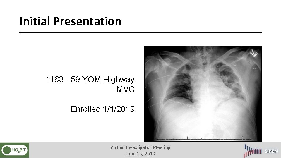 Initial Presentation 1163 - 59 YOM Highway MVC Enrolled 1/1/2019 Virtual Investigator Meeting June