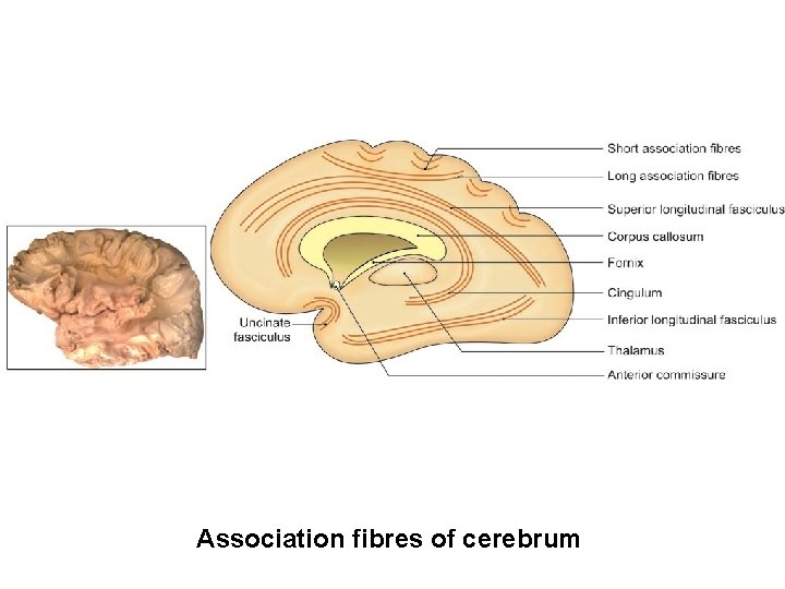 Association fibres of cerebrum 