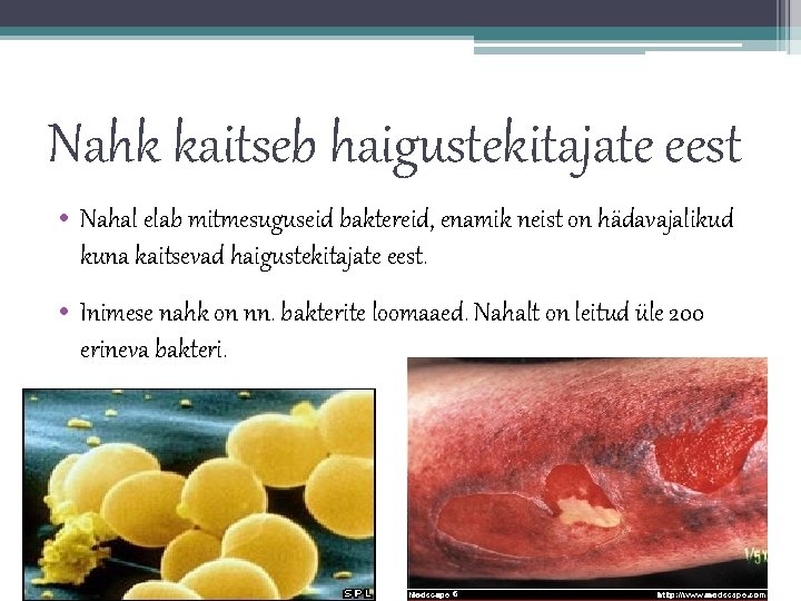 Nahk kaitseb haigustekitajate eest • Nahal elab mitmesuguseid baktereid, enamik neist on hädavajalikud kuna