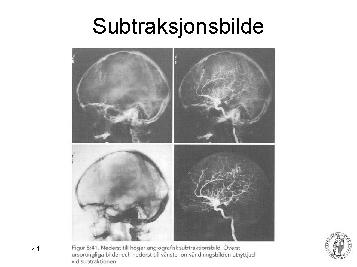 Subtraksjonsbilde 41 Fysisk institutt - Rikshospitalet 