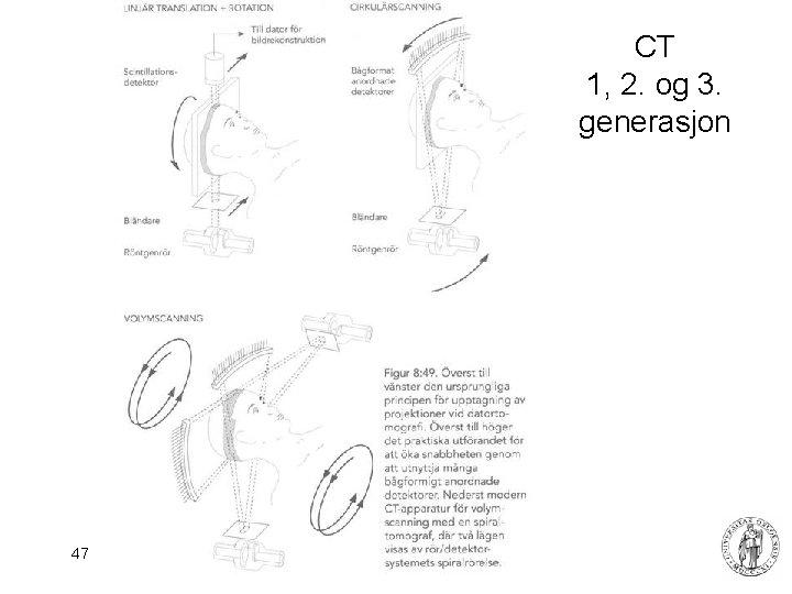 CT 1, 2. og 3. generasjon 47 Fysisk institutt - Rikshospitalet 